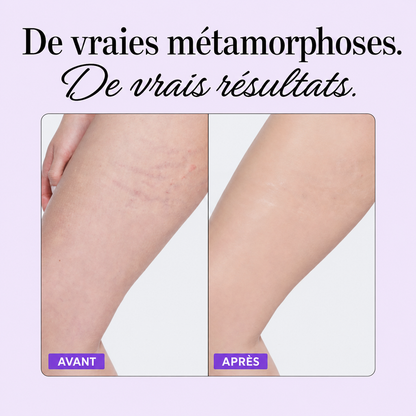 Perfecteur de corps