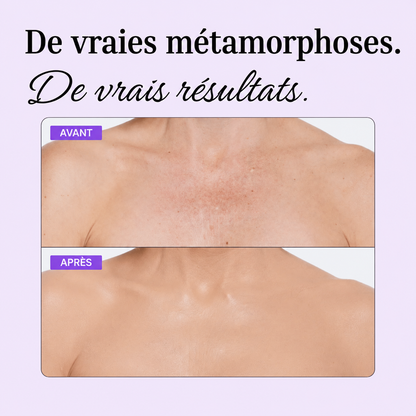 Perfecteur de corps